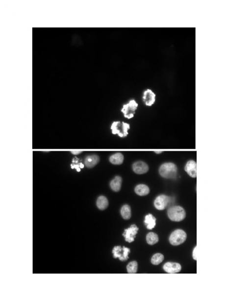 Phospho-Histone H3 (Ser10) Antibody in Immunocytochemistry (ICC/IF)