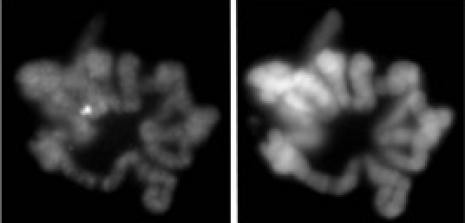 Phospho-Histone H3 (Ser28) Antibody in Immunocytochemistry (ICC/IF)