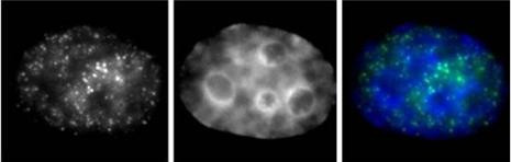 Phospho-RNA pol II CTD (Ser7) Antibody in Immunocytochemistry (ICC/IF)