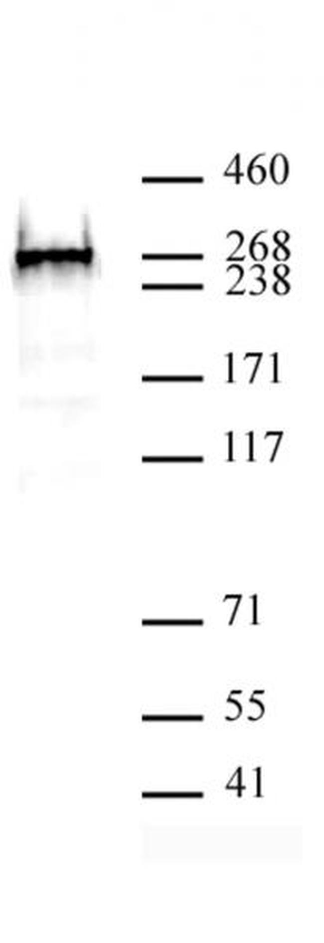 BAZ2A Antibody in Western Blot (WB)