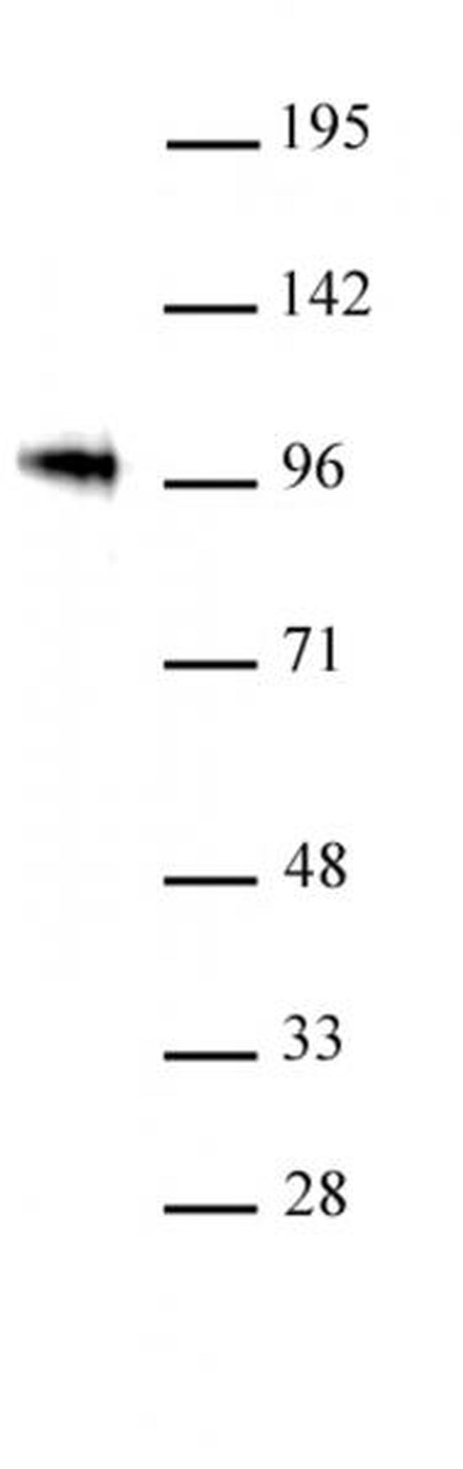 SOX6 Antibody in Western Blot (WB)