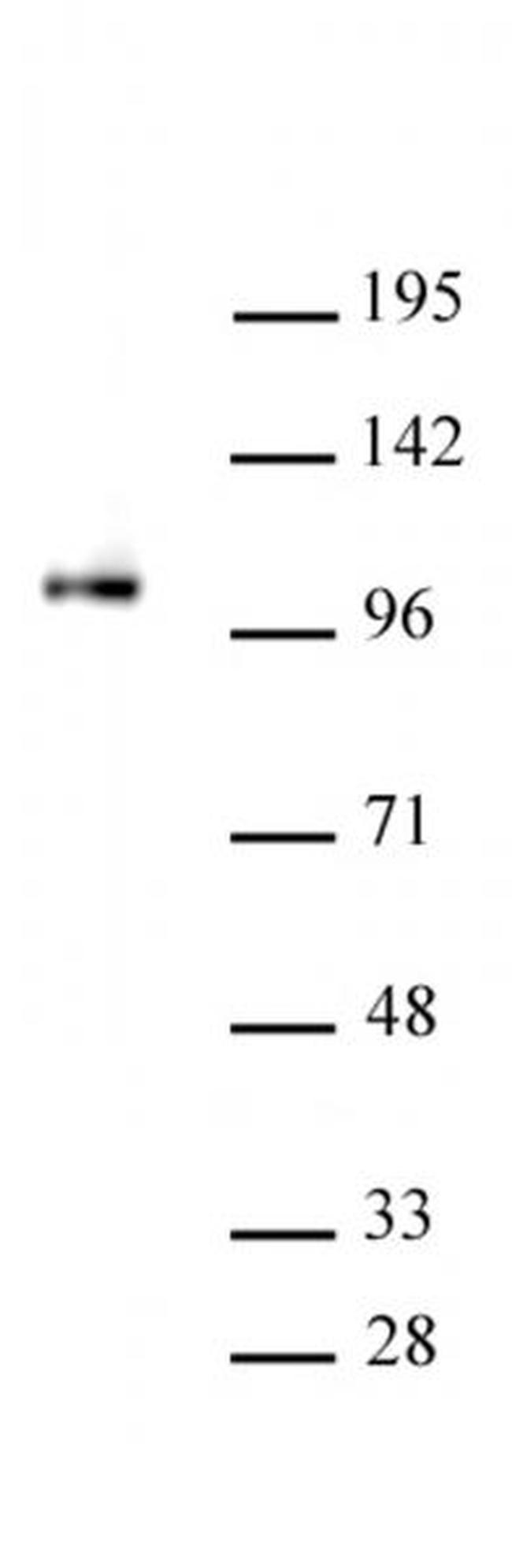 SFMBT1 Antibody in Western Blot (WB)