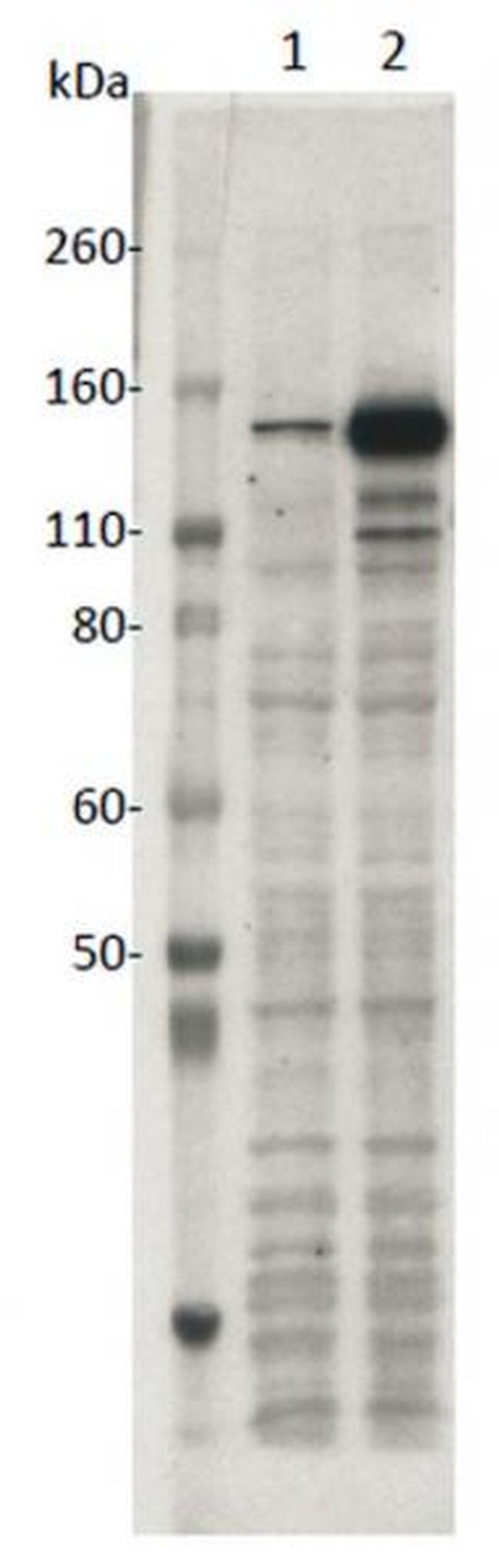 SaCas9 Antibody in Western Blot (WB)