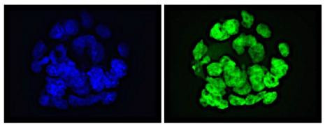 GLIS1 Antibody in Immunocytochemistry (ICC/IF)