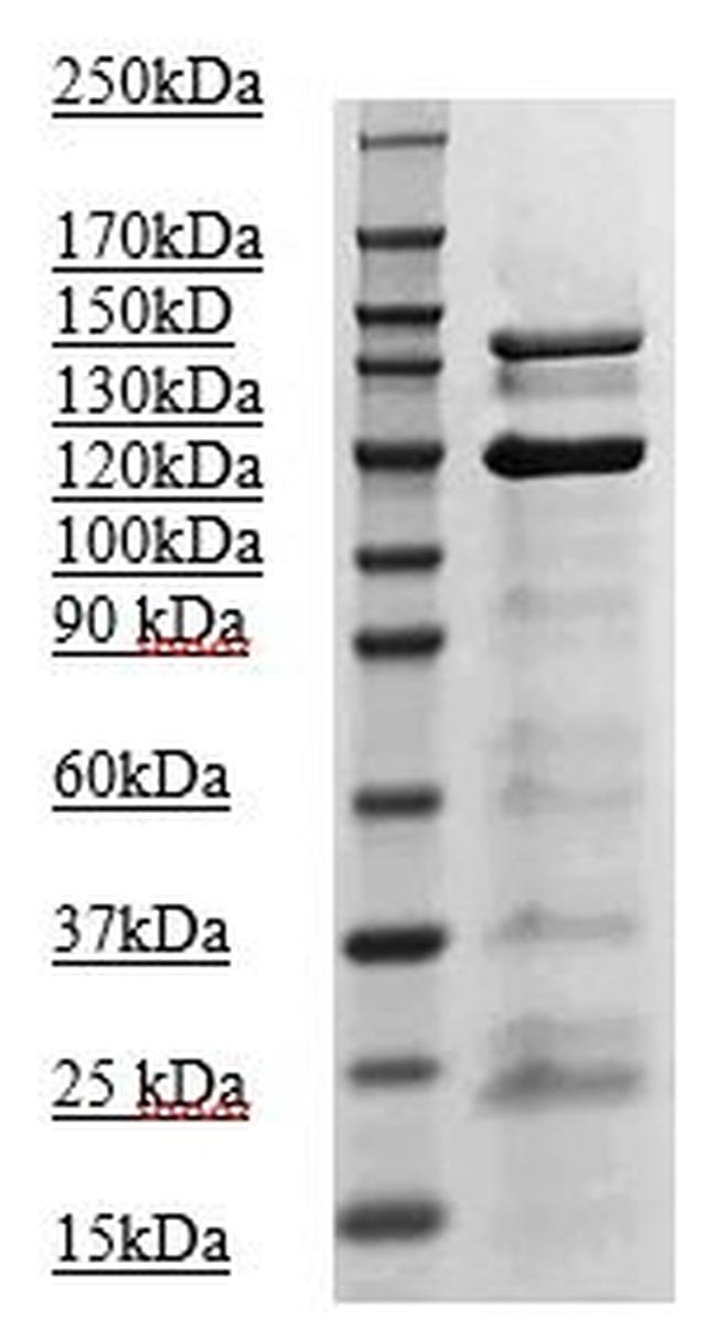 Phospho-JAK2 (Tyr1007, Tyr1008) Antibody in Western Blot (WB)