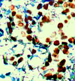 Phospho-ER (Ser305) Antibody in Immunohistochemistry (Paraffin) (IHC (P))