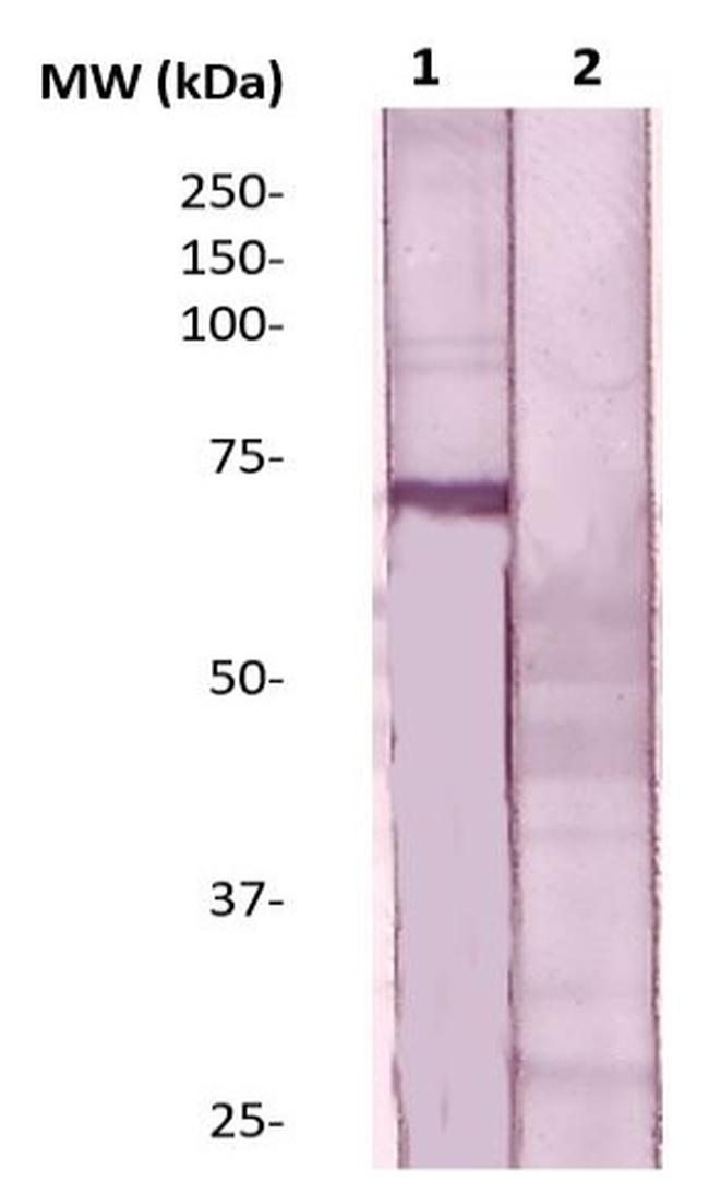 ER Antibody in Western Blot (WB)