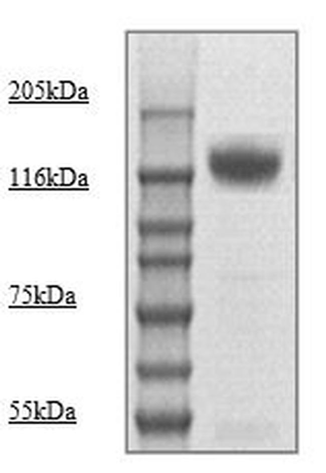 Phospho-Neuropilin-1 (Thr916) Antibody in Western Blot (WB)