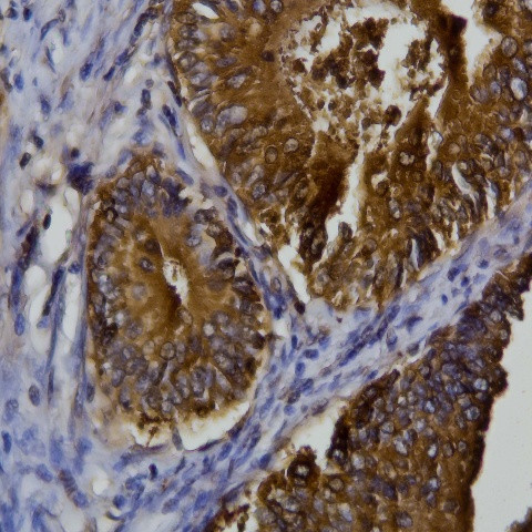 PLAC1 Antibody in Immunohistochemistry (Paraffin) (IHC (P))
