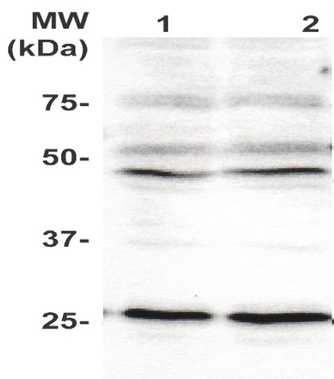 Phospho-PLAC1 (Tyr147) Antibody in Western Blot (WB)