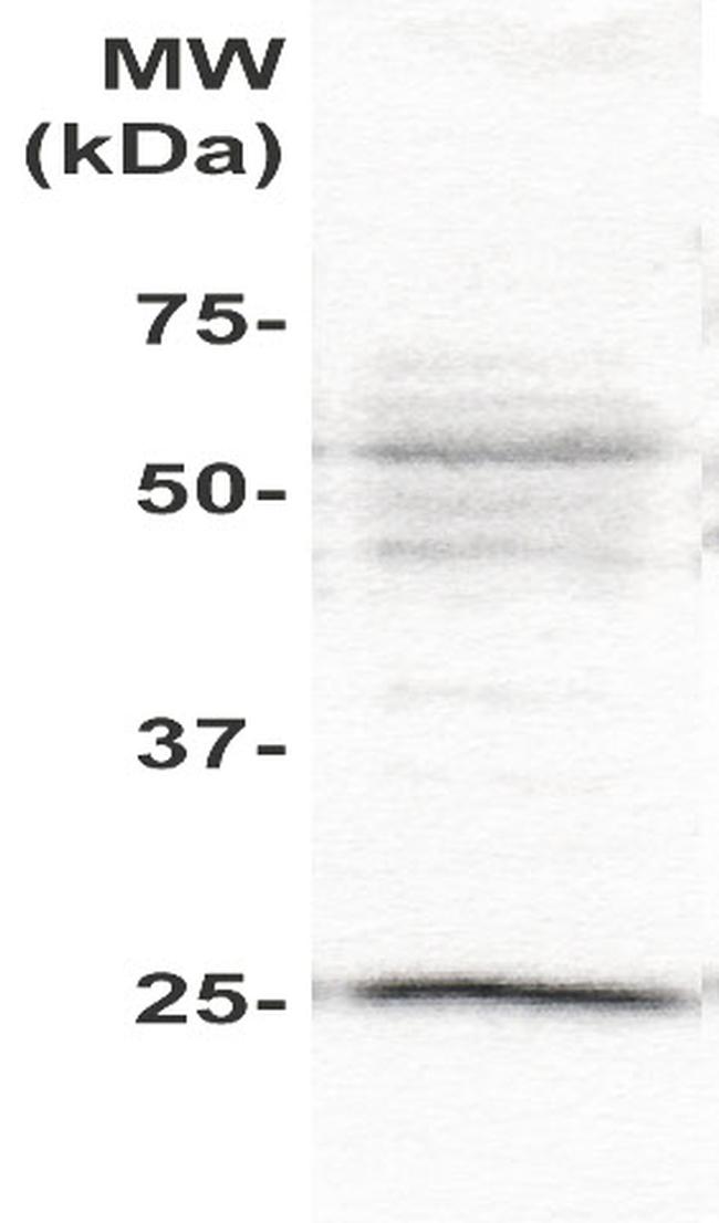 PLAC1 Antibody in Western Blot (WB)