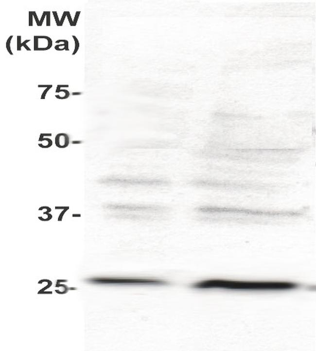 Phospho-PLAC1 (Ser156) Antibody in Western Blot (WB)