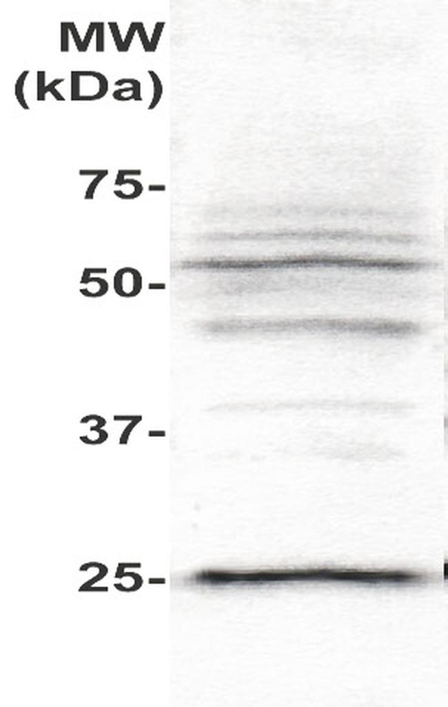 PLAC1 Antibody in Western Blot (WB)