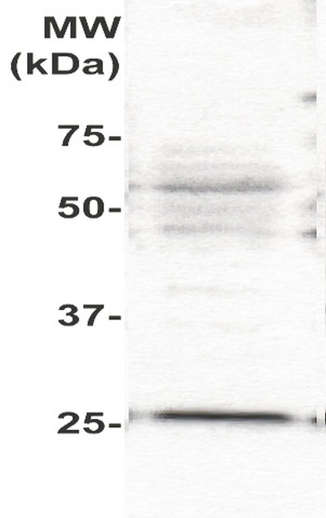 PLAC1 Antibody in Western Blot (WB)