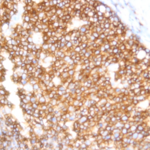 SSEA2 Antibody in Immunohistochemistry (Paraffin) (IHC (P))