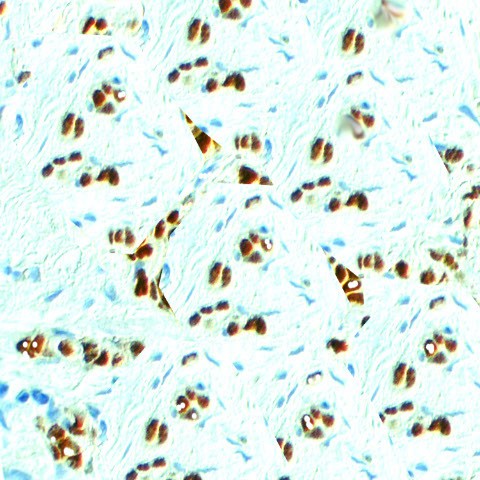 Nanog Antibody in Immunohistochemistry (Paraffin) (IHC (P))