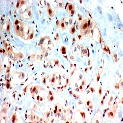 PAX8 Antibody in Immunohistochemistry (Paraffin) (IHC (P))