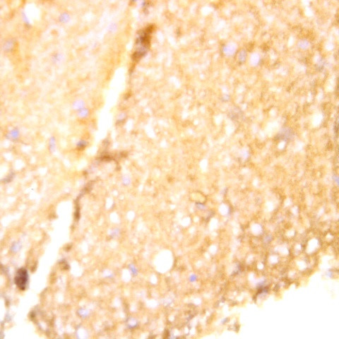 Tau Antibody in Immunohistochemistry (Paraffin) (IHC (P))
