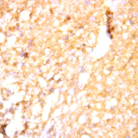 Phospho-Tau (Ser384) Antibody in Immunohistochemistry (Paraffin) (IHC (P))