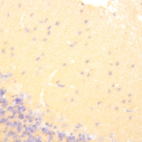 Tau Antibody in Immunohistochemistry (Paraffin) (IHC (P))