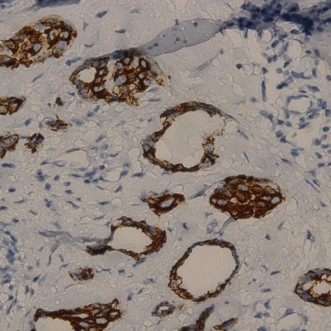 Phospho-RalA (Ser196) Antibody in Immunohistochemistry (Paraffin) (IHC (P))