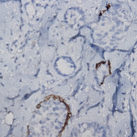RalA Antibody in Immunohistochemistry (Paraffin) (IHC (P))