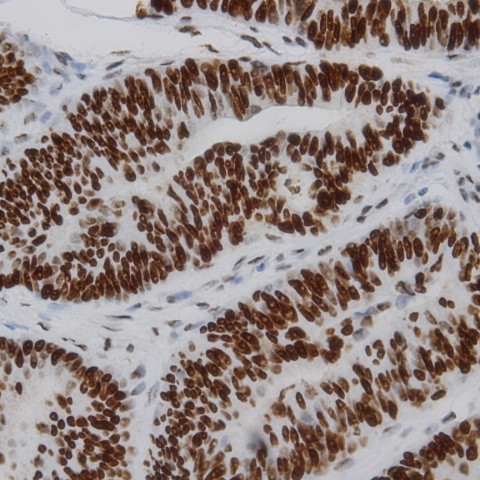 Phospho-IKK-a (Ser176, Ser180) Antibody in Immunohistochemistry (Paraffin) (IHC (P))