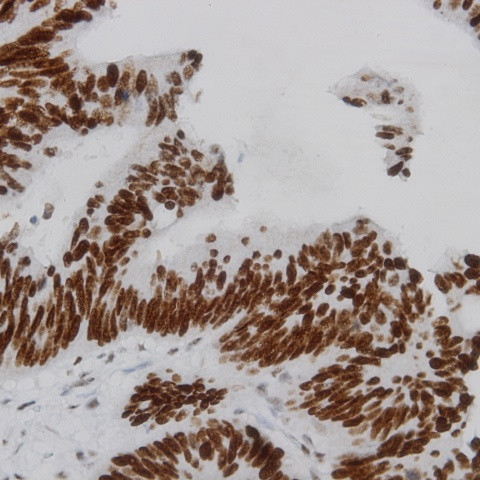 Phospho-IKK-b (Tyr199) Antibody in Immunohistochemistry (Paraffin) (IHC (P))