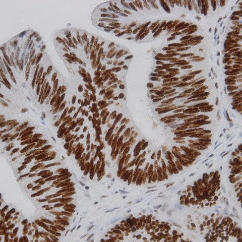 IKK-b Antibody in Immunohistochemistry (Paraffin) (IHC (P))