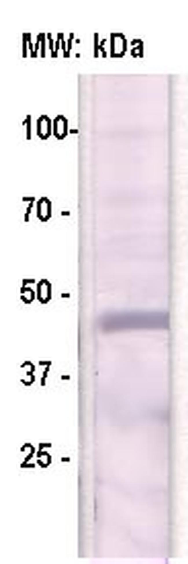 HPV (Human Papillomavirus), E7 protein Antibody in Western Blot (WB)