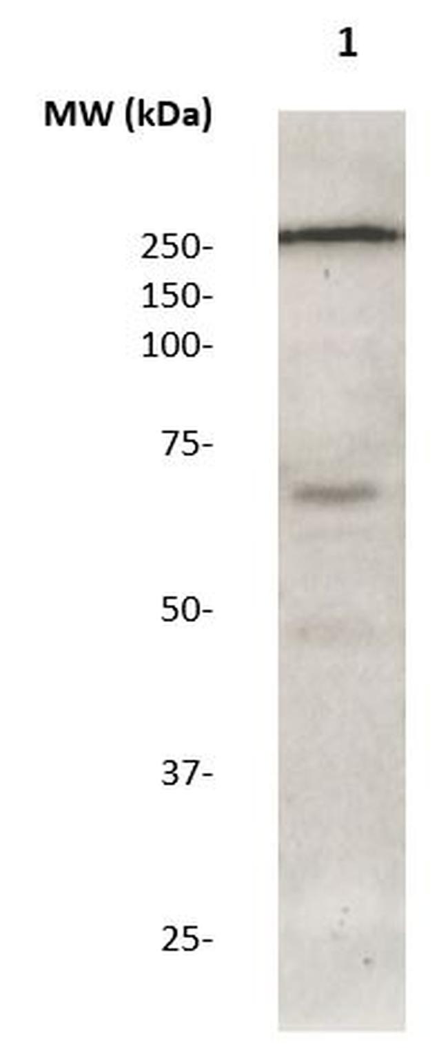 Phospho-LRRK2 (Ser1124) Antibody in Western Blot (WB)