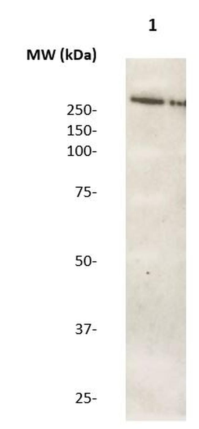 LRRK2 Antibody in Western Blot (WB)