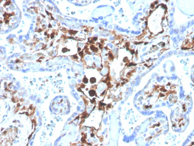S100A4/Metastasin/Calvasculin (Marker of Tumor Metastasis) Antibody in Immunohistochemistry (Paraffin) (IHC (P))
