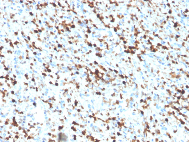 S100A4/Metastasin/Calvasculin (Marker of Tumor Metastasis) Antibody in Immunohistochemistry (Paraffin) (IHC (P))