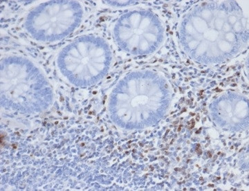 S100A4/Metastasin/Calvasculin (Marker of Tumor Metastasis) Antibody in Immunohistochemistry (Paraffin) (IHC (P))