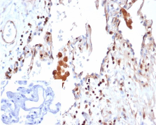 S100A4/Metastasin/Calvasculin (Marker of Tumor Metastasis) Antibody in Immunohistochemistry (Paraffin) (IHC (P))