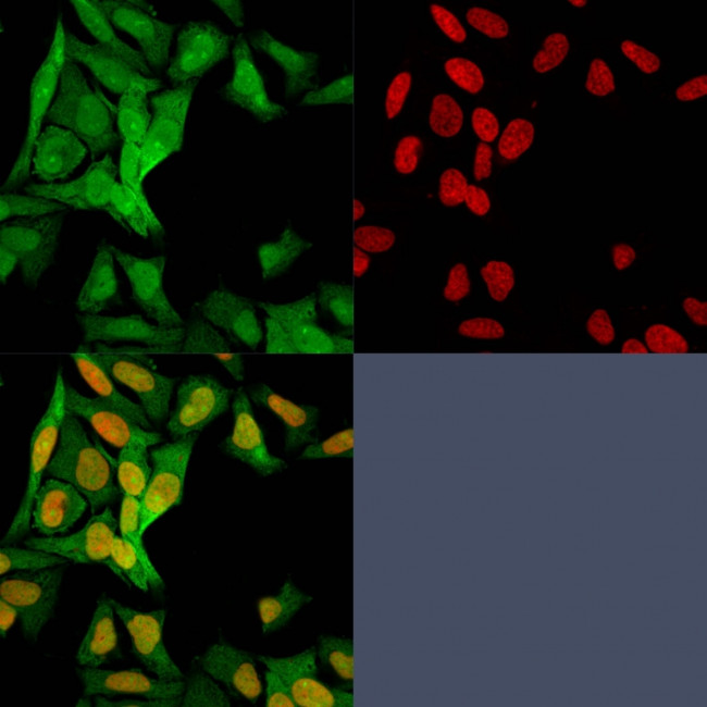 S100A4/Metastasin/Calvasculin (Marker of Tumor Metastasis) Antibody in Immunocytochemistry (ICC/IF)