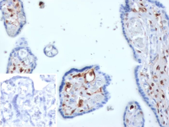 S100A4/Metastasin/Calvasculin (Marker of Tumor Metastasis) Antibody in Immunohistochemistry (Paraffin) (IHC (P))