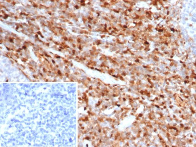 S100A4/Metastasin/Calvasculin (Marker of Tumor Metastasis) Antibody in Immunohistochemistry (Paraffin) (IHC (P))