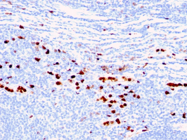 Calprotectin/MRP14/S100A9/Calgranulin B Antibody in Immunohistochemistry (Paraffin) (IHC (P))