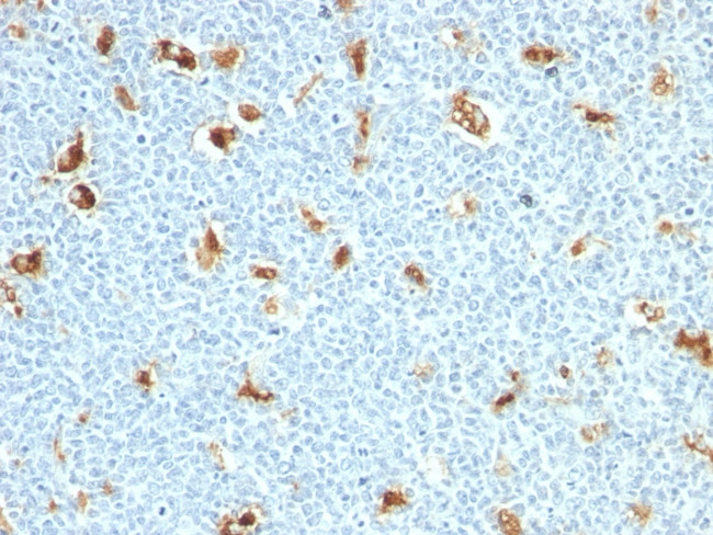 Calprotectin/MRP14/S100A9/Calgranulin B Antibody in Immunohistochemistry (Paraffin) (IHC (P))