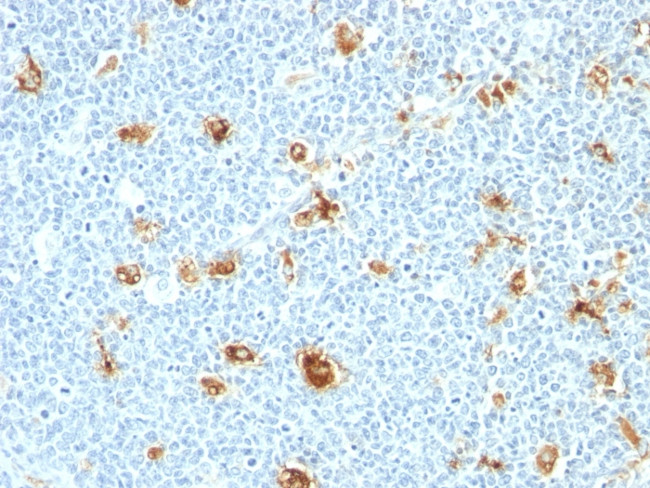 Calprotectin/MRP14/S100A9/Calgranulin B Antibody in Immunohistochemistry (Paraffin) (IHC (P))