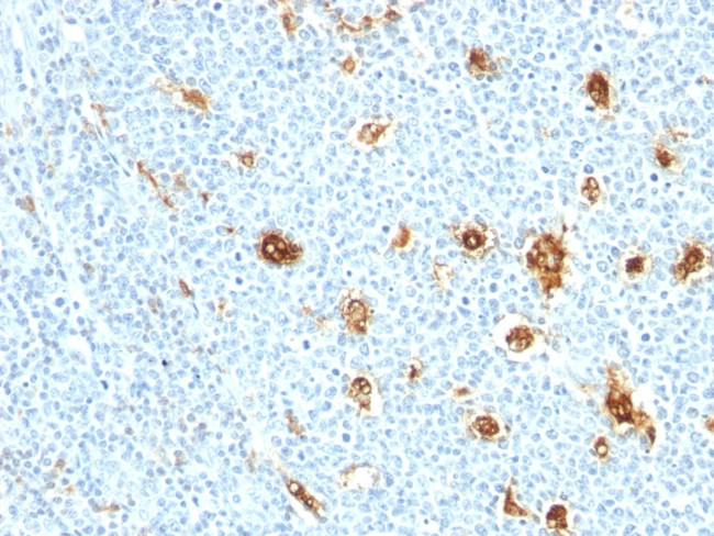 Calprotectin/MRP14/S100A9/Calgranulin B Antibody in Immunohistochemistry (Paraffin) (IHC (P))