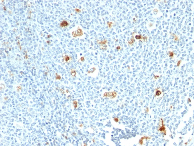 Calprotectin/MRP14/S100A9/Calgranulin B Antibody in Immunohistochemistry (Paraffin) (IHC (P))