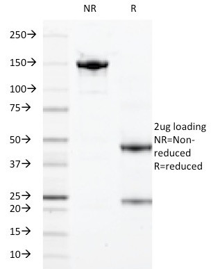 Calprotectin/MRP14/S100A9/Calgranulin B Antibody in SDS-PAGE (SDS-PAGE)