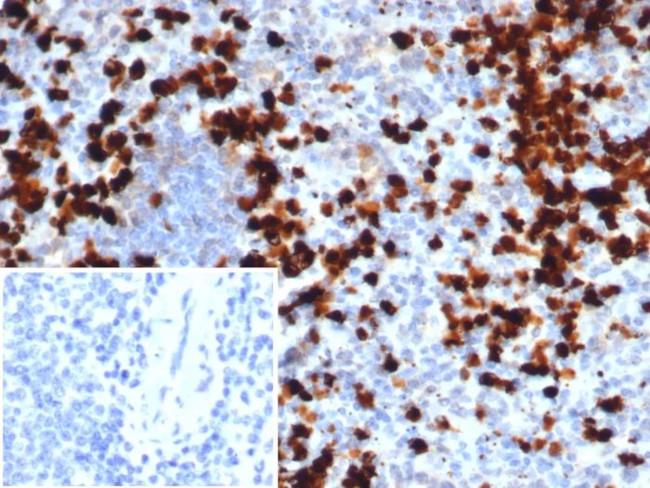 Calprotectin/MRP14/S100A9/Calgranulin B Antibody in Immunohistochemistry (Paraffin) (IHC (P))