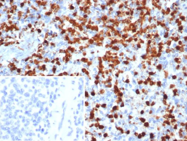 Calprotectin/MRP14/S100A9/Calgranulin B Antibody in Immunohistochemistry (Paraffin) (IHC (P))