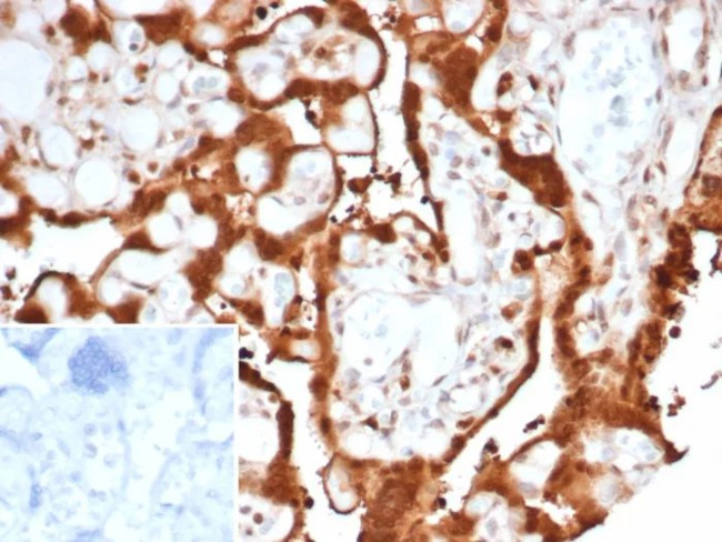 S100A11 (S100 calcium binding protein A11)/Calgizzarin Antibody in Immunohistochemistry (Paraffin) (IHC (P))