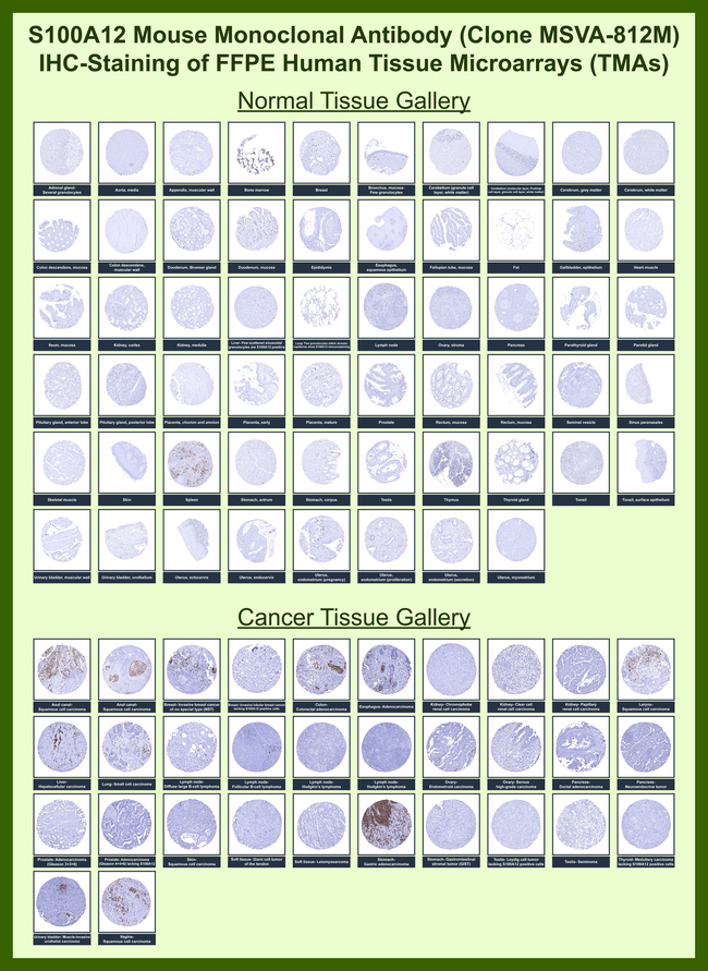 S100A12/CGRP Antibody in Immunohistochemistry (Paraffin) (IHC (P))