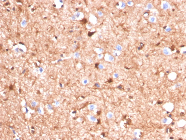 S100B (Astrocyte and Melanoma Marker) Antibody in Immunohistochemistry (Paraffin) (IHC (P))